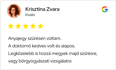általános vélemény