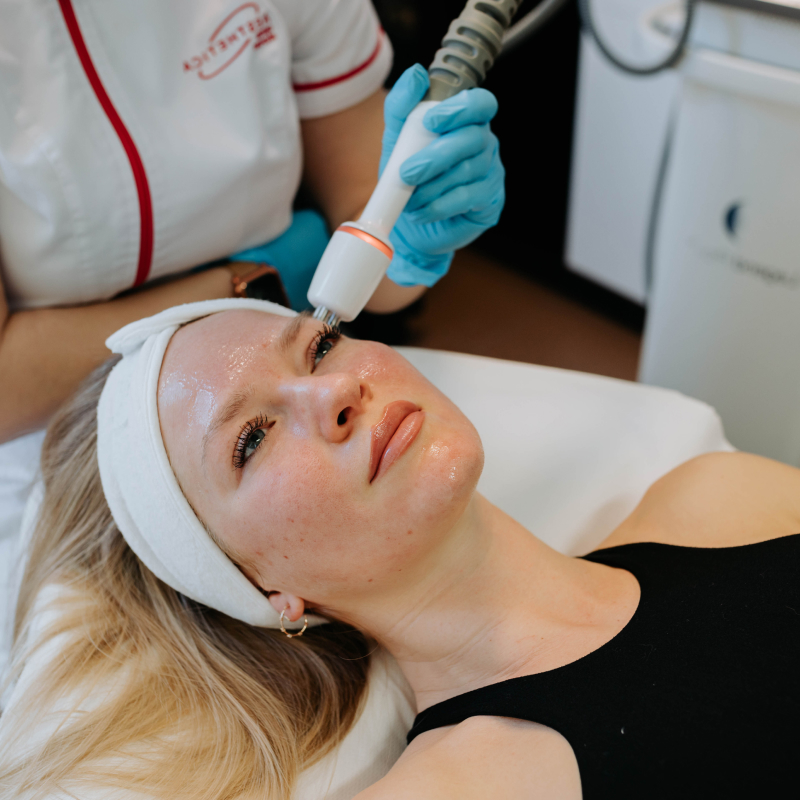 Oczella Krisztina biolifting kezelés
